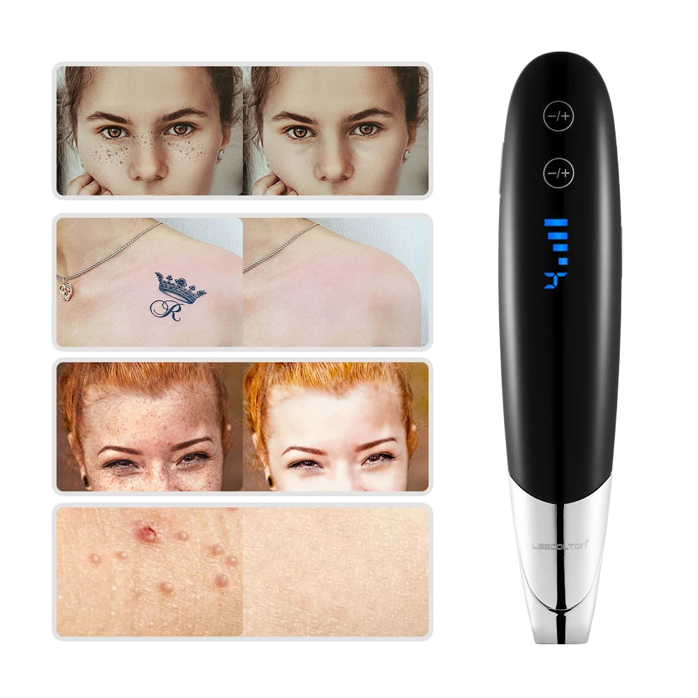 Laser Picosecond Pen Freckle Tattoo Removal Aiming Target Locate Position Mole Spot Eyebrow Pigment Remover Acne Beauty Care