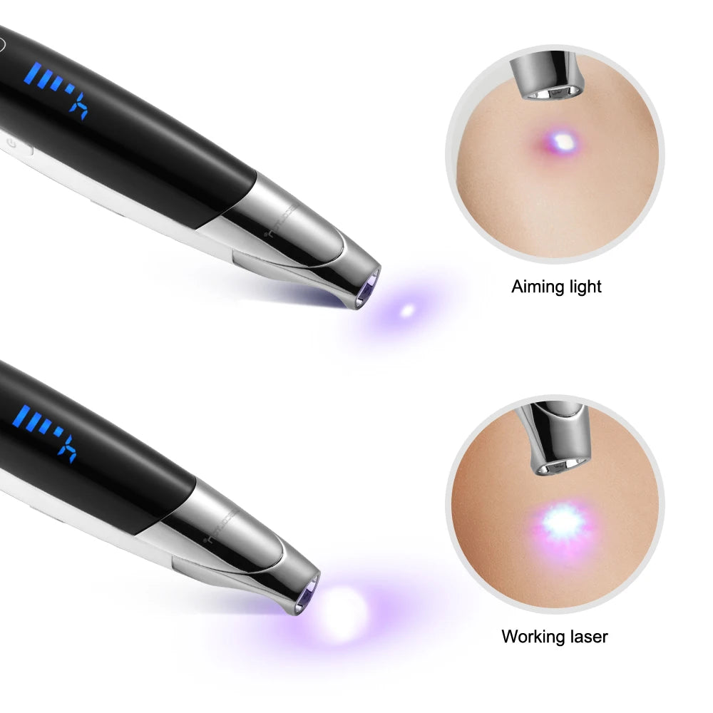 Laser Picosecond Pen Freckle Tattoo Removal Aiming Target Locate Position Mole Spot Eyebrow Pigment Remover Acne Beauty Care